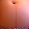 linea alba sesso bambino