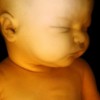 feto che dorme