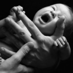 Nasce a 31 settimane da madre con tumore