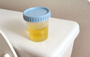 esami delle urine in gravidanza