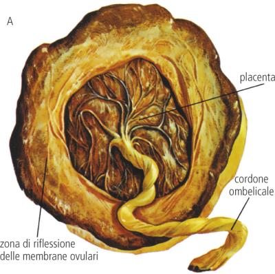 placenta cordone ombelicale