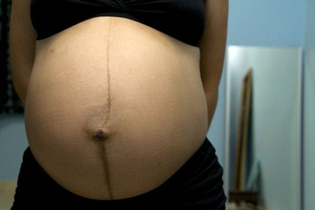 linea nigra durante la gravidanza