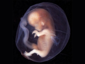 feto nel liquido amniotico