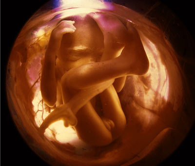 feto si sfrega contro la parete uterina