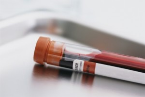 analisi sangue malattie veneree gravidanza