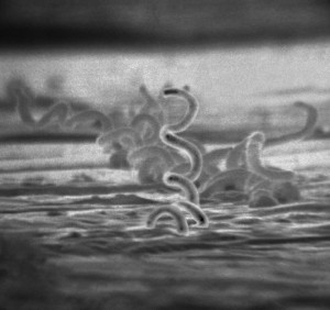 treponema pallidum batterio sifilide