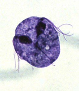 trichomonas vaginalis 