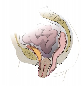 utero prolassato 