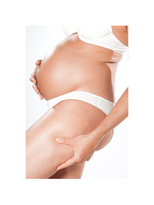 cellulite in gravidanza