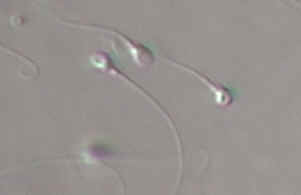 sterilità-spermatozoi