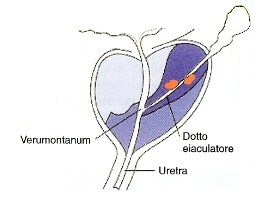 condotto eiaculatore