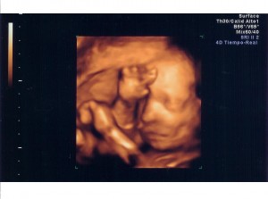 feto-crescita