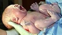 neonato-corpo