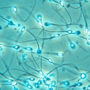 spermatozoi