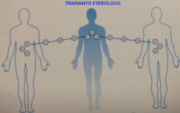 TRAPIANTO ETEROLOGO CELLULE STAMINALI