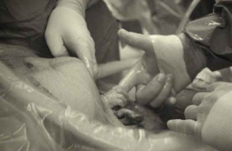 Bambina stringe la mano di un medico
