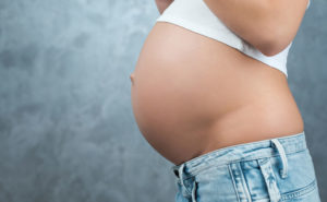 Rimedi naturali per togliere smagliature in gravidanza